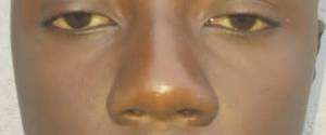 Bete Courage