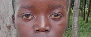 David Otieno