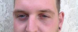 Ryan Bedingfield