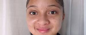 Skyler Fortuin